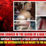 Gaibandha Soaked in the Blood of a BGB Soldier BNP Leader Rayhan’s Machete Attack Leaves Sumon Wounded — Silence from the Authorities Is an Insult to the Nation!