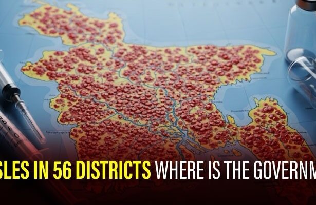 Measles in 56 Districts — Where Is the Government?